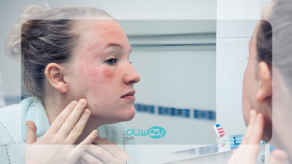 اگزمای پوستی